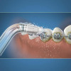 Testina di Ricambio Waterpik OD-100E